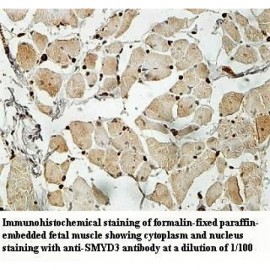 SMYD3 Antibody