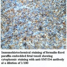 SMYD4 Antibody