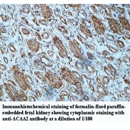 ACAA2 Antibody