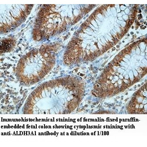 ALDOA Antibody