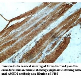 AMPD2 Antibody
