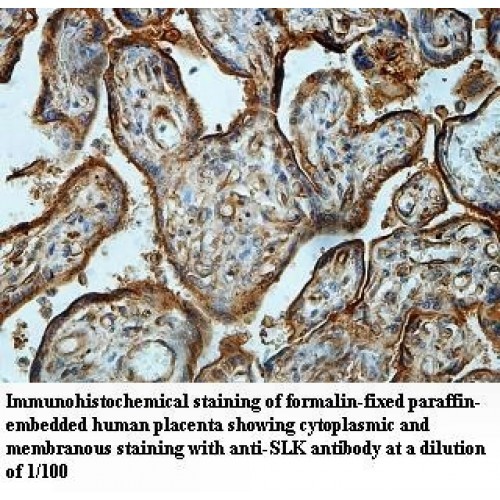 SLK Antibody