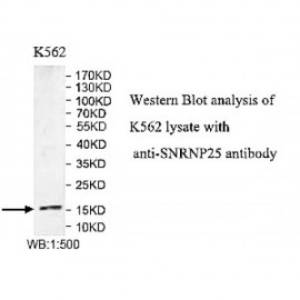 SNRNP25 Antibody