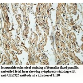 UBE2Q2 Antibody