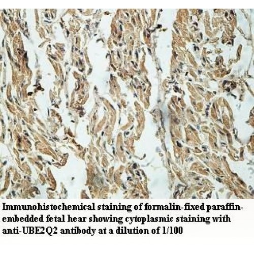 UBE2Q2 Antibody