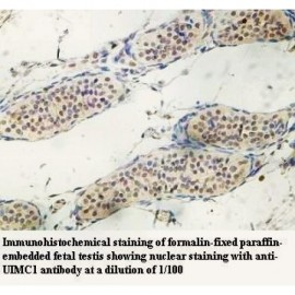UIMC1 Antibody