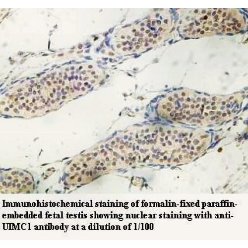 UIMC1 Antibody