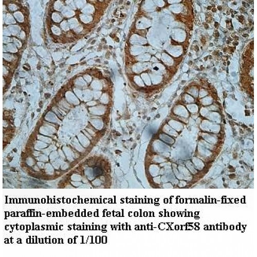 CXorf58 Antibody