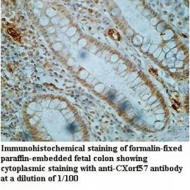 CXorf57 Antibody