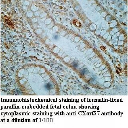 CXorf57 Antibody