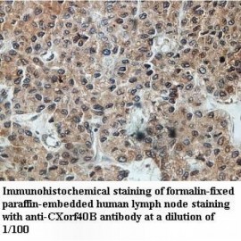 CXorf40B Antibody