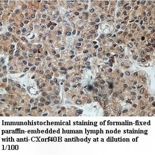 CXorf40B Antibody