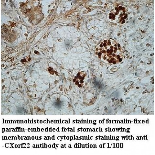 CXorf22 Antibody