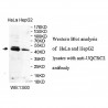 UQCRC2 Antibody