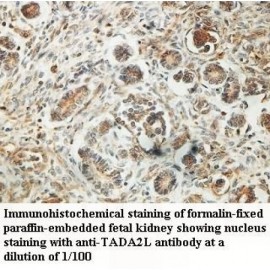 TADA2L Antibody