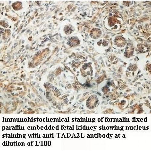 TADA2L Antibody