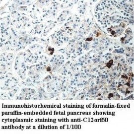 C14orf60 Antibody