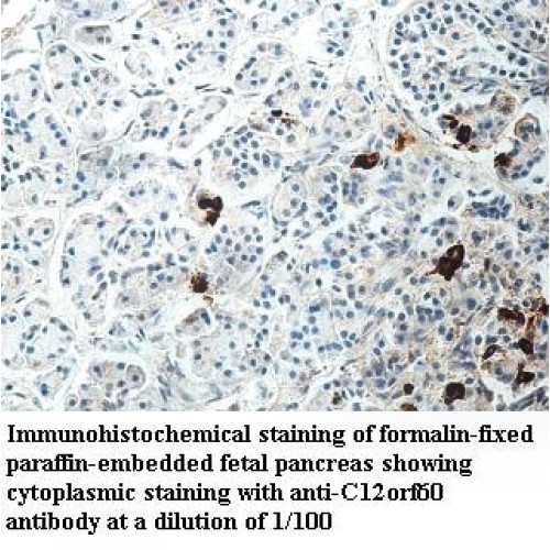 C14orf60 Antibody