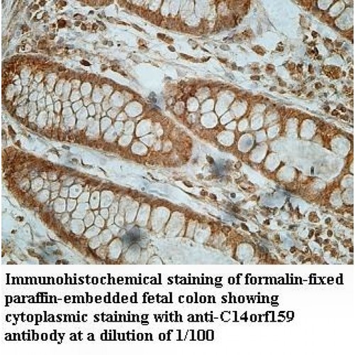 C14orf159 Antibody