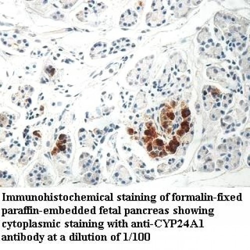 CYP24A1 Antibody