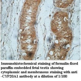 CYP20A1 Antibody