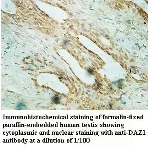 DAZ1 Antibody