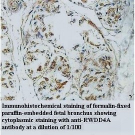 RWDD4A Antibody
