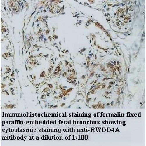 RWDD4A Antibody