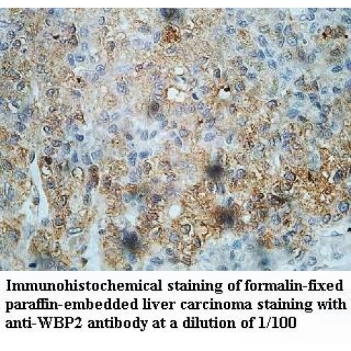 WBP2 Antibody