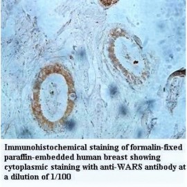 WARS Antibody