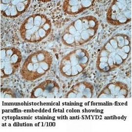 SMYD2 Antibody