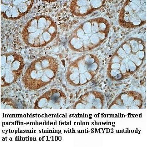 SMYD2 Antibody