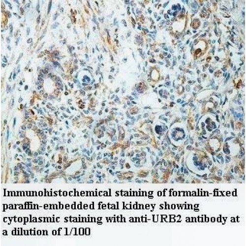 URB2 Antibody