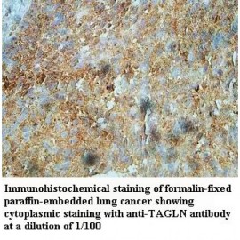 TAGLN Antibody