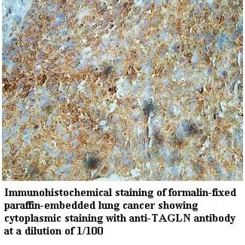 TAGLN Antibody