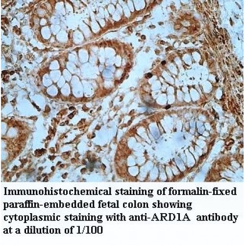 ARD1A Antibody