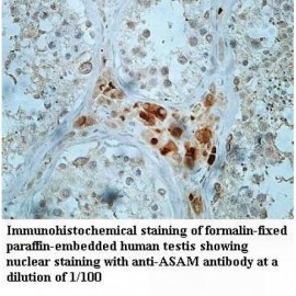ASAM Antibody