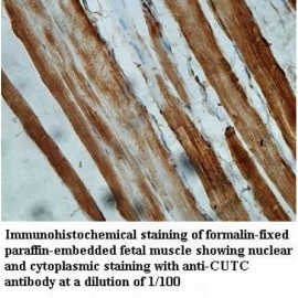 CUTC Antibody