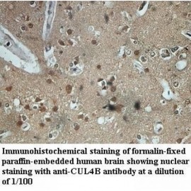 CUL4B Antibody