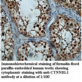 CTNNBL1 Antibody