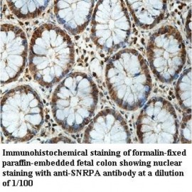 SNRPA Antibody