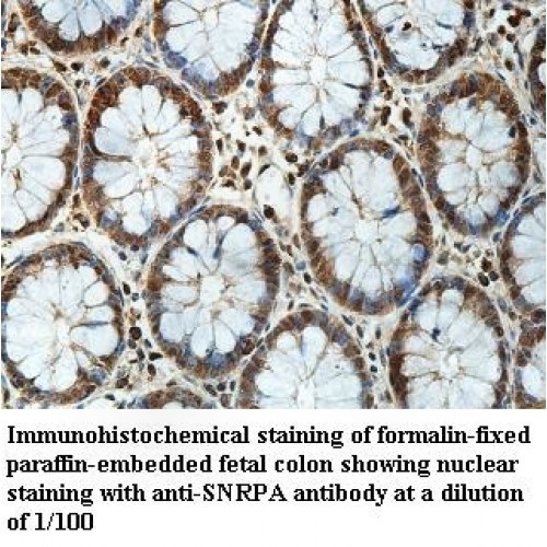 SNRPA Antibody