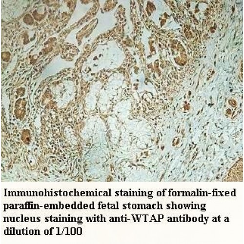 WTAP Antibody