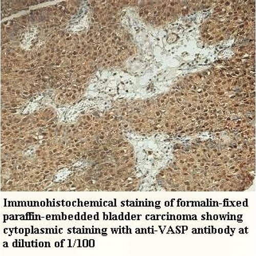 VASP Antibody