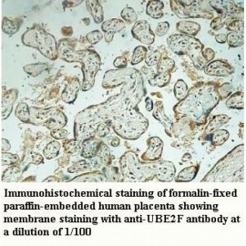 UBE2F Antibody