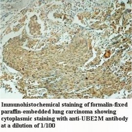 UBE2M Antibody
