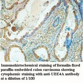 UBE4A Antibody