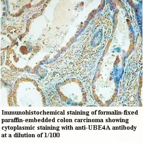 UBE4A Antibody