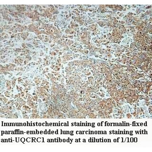 UQCRC1 Antibody