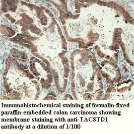 TACSTD1 Antibody